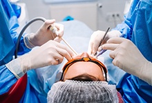 Dentists performing dental implant surgery