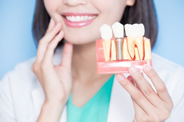 Holding model of dental implants.